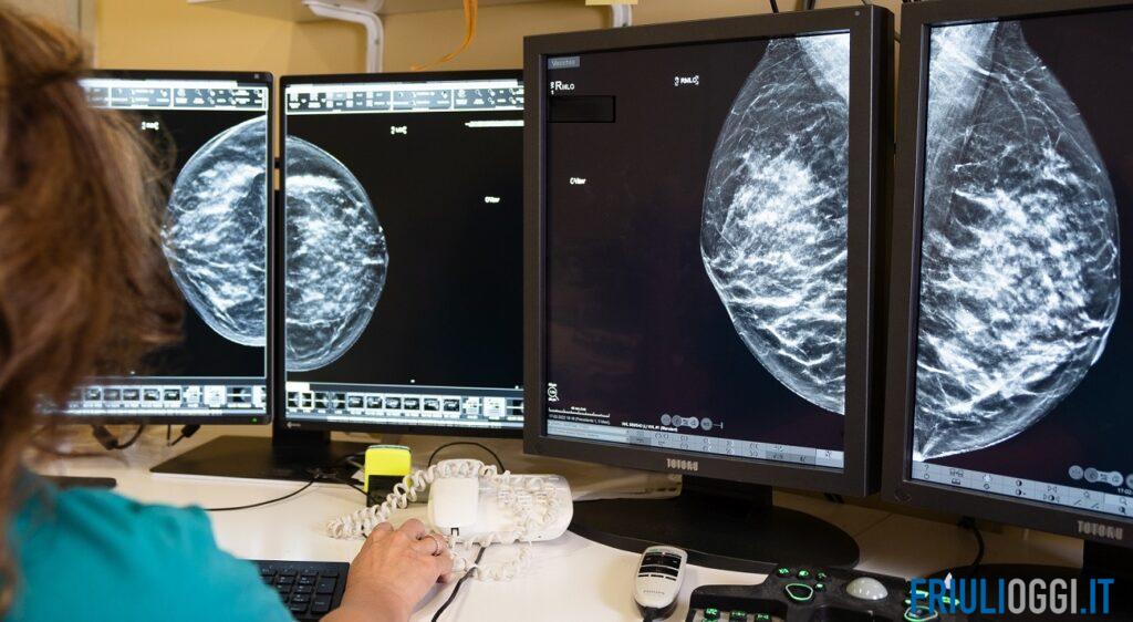 Tumore al seno, in Fvg con la diagnosi precoce la sopravvivenza supera il 90%